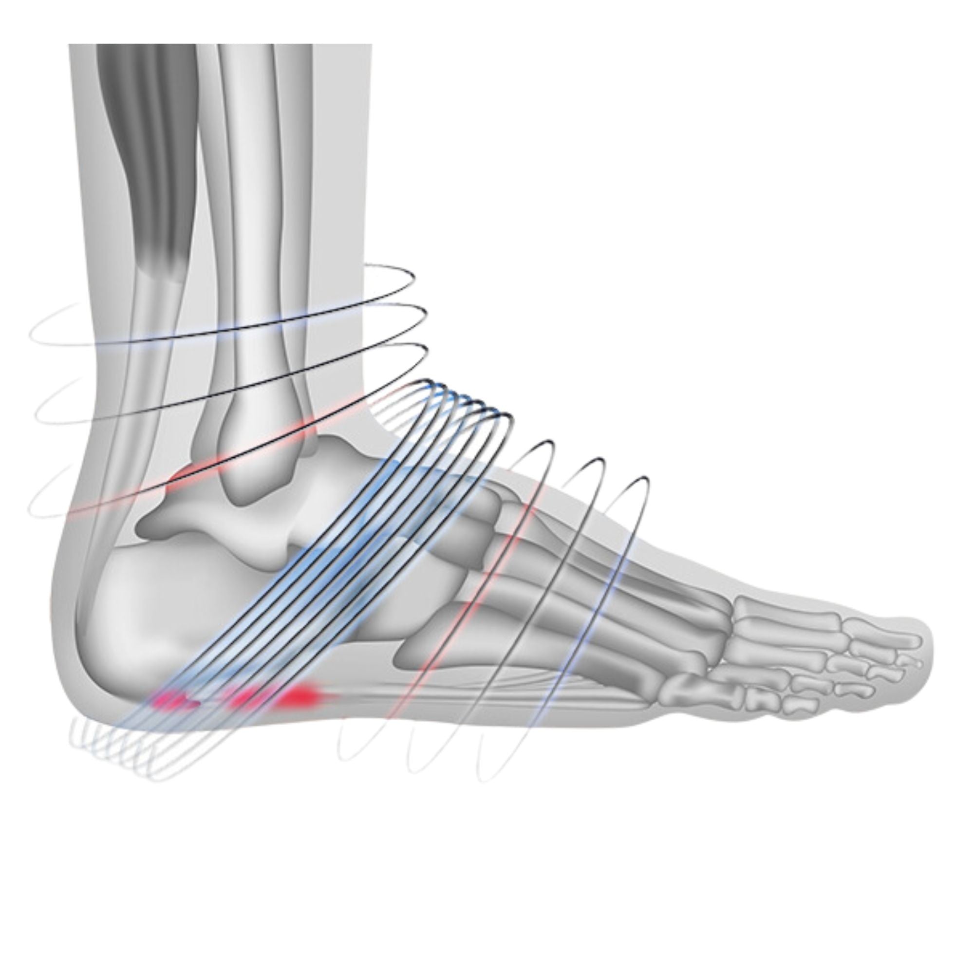Complete kit for heel spurs with compression sock, insole & night splint