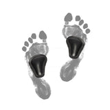 Self-adhesive pads for sunken forefoot arches