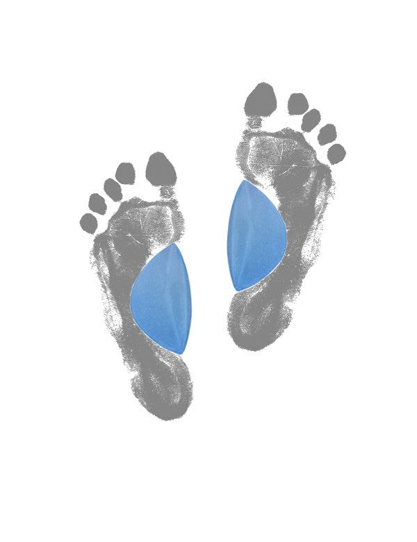 Arch support for the arch of the foot