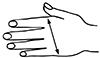 Kompressionshandske Ødemhandske_size-guide