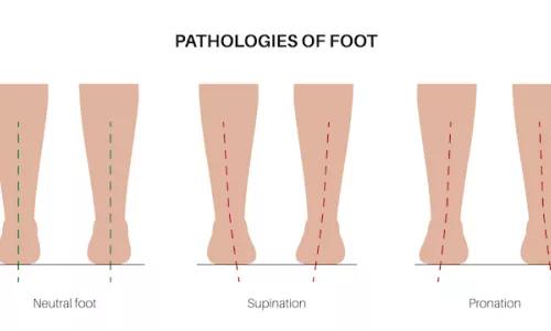 Pathologies of foot Pathologies of foot
